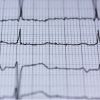 Common Heart Problems and What You Can Do to Prevent Them
